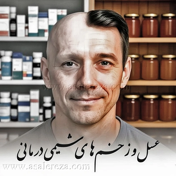 عسل برای زخم های شیمی درمانی