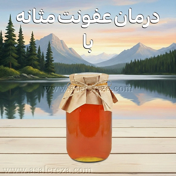 درمان عفونت مثانه با عسل طبیعی
